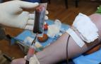 Rusya’da hızla yayılan yeni bir HIV virüs türü keşfedildi