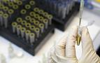 Rus bayan atletlere doping şoku