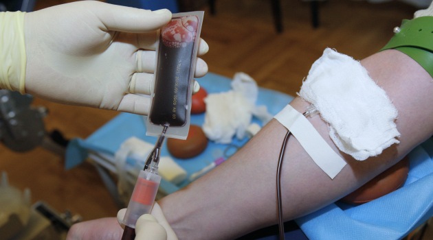 Rusya’da hızla yayılan yeni bir HIV virüs türü keşfedildi